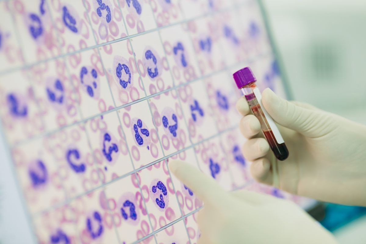 Doctor or medical technologist analyzing blood test in laboratory about automated digital cell morphology analyzer for determining leukocyte differential counts in peripheral blood smear (PBS).